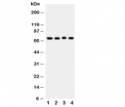 Western blot testing of ABCG2 antibody and Lane 1:  rat liver;  2: rat spleen;  3: rat kidney;  4: mouse spleen tissue lysate. Predicted molecular weight ~72kDa.