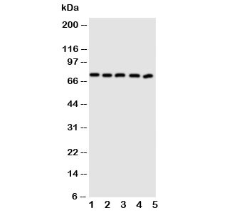 Western blot testing of ABCG5 antibody and human lysate samples 1: MCF-7; 2: A549; 3: HT1080; 4: U-87 MG; 5: SKOV. Predicted molecular weight ~73 kDa.~