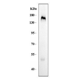Western blot testing of human placental tissue lysate with CD163 antibody. Predicted molecular weight ~130 kDa but may be observed at higher molecular weights due to glycosylation.