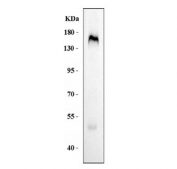 Western blot testing of human placental tissue lysate with CD163 antibody. Predicted molecular weight ~130 kDa but may be observed at higher molecular weights due to glycosylation.
