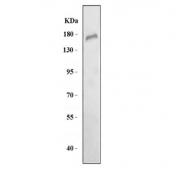 Western blot testing of human HCCT cell lysate with CD163 antibody. Predicted molecular weight ~130 kDa but may be observed at higher molecular weights due to glycosylation.
