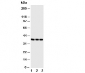 Western blot testing of CD1a antibody and Lane 1:  Jurkat;  2: SW620;  3: CEM cell lysate. Predicted molecular weight: 37~49 kDa.