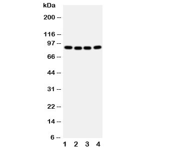 Western blot testing of CUL2 antibody and human samples 1: A431; 2: SMMC-7721; 3: HeLa; 4: COLO320 cell lysate. Predicted/observed size: ~87KD
