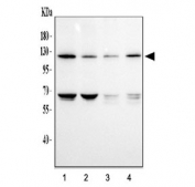 Western blot testing of human 1) HeLa, 2) K562, 3) A549 and 4) Caco-2 cell lysate with DDR1 antibody. Expected molecular weight: 100-125 kDa.