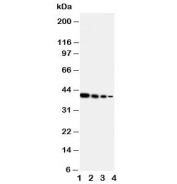 Western blot testing of ERBB4 antibody and Lane 1:  Recombinant human partial protein 10ng;  2: 5ng;  3: 2.5ng;  4: 1.25ng