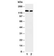 Western blot testing of ERBB4 antibody and Lane 1:  A549;  2: HeLa cell lysate. Predicted molecular weight: 147-180kDa (precursor), 120, 80 kDa (cleaved forms). Observed here at ~147kDa.
