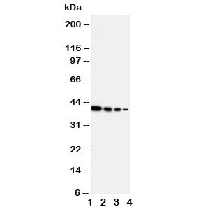 Western blot testing of ERBB4 antibody and Lane 1: Recombinant human protein 10ng; 2: 5ng; 3: 2.5ng; 4: 1.25ng