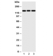 Western blot testing of ERBB4 antibody and Lane 1:  human HeLa;  2: (h) U87;  3: mouse Neuro-2a cell lysate.  Predicted molecular weight: 147-180kDa (precursor), 120, 80 kDa (cleaved forms). Observed here at ~147kDa.