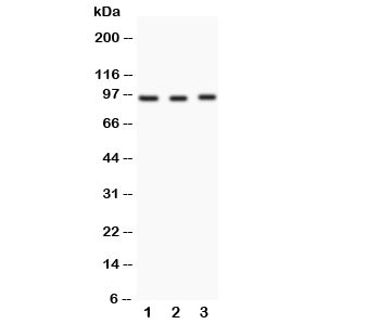 Western blot testing of FER antibody and Lane 1: HeLa; 2: rat testis; 3: rat ovary
