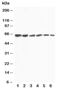 Western blot testing of FMO4 antibody and Lane 1: rat liver; 2: mouse liver; 3: human SMMC-7721; 4: (m) HEPA; 5: (h) A431; 6: (h) MCF-7 cell lysate. Predicted size ~63KD~