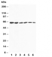 Western blot testing of FMO4 antibody and Lane 1:  rat liver;  2: mouse liver;  3: human SMMC-7721;  4: (m) HEPA;  5: (h) A431;  6: (h) MCF-7 cell lysate.  Predicted size ~63KD