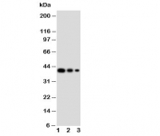 Western blot testing of GATA2 antibody and Lane 1:  recombinant human protein 10ng;  2: 5ng;  3: 2.5ng