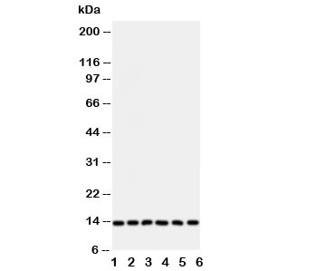 Western blot testing of Glutaredoxin 2 antibody and Lane 1: rat testis; and human samples 2: HeLa; 3: U87; 4: NEU; 5: Jurkat; 6: MCF-7 cell lysate~