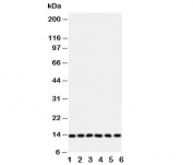 Western blot testing of Glutaredoxin 2 antibody and Lane 1:  rat testis;  and human samples 2: HeLa;  3: U87;  4: NEU;  5: Jurkat;  6: MCF-7 cell lysate