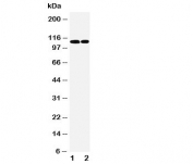 Western blot testing of p107 antibody and Lane 1:  239T;  2: Jurkat cell lysate