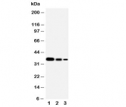 Western blot testing of SHC antibody and Lane 1:  Recombinant human protein 10ng;  2: 5ng;  3: 2.5ng