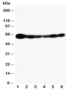 Western blot testing of SHC antibody and Lane 1: rat brain; and human samples 2: A549; 3: A431; 4: 293T; 5: HeLa; 6: Jurkat cell lysate. Predicted size ~63KD