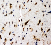 IHC-P: SHC antibody testing of rat brain tissue. HIER: steamed with pH6 citrate buffer.