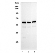 Western blot testing of human 1) HeLa, 2) MCF7 and 3) MDA-MB-453 cell lysate with Smad2 antibody. Predicted molecular weight: 52~60 kDa.