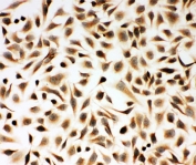 ICC staining of human HeLa cells with Smad2 antibody.