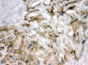 IHC-F testing of SOD3 antibody and human placenta tissue