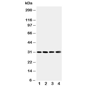 Western blot testing of SOD3 antibody and Lane 1: human placenta; 2: A549; 3: MM231; 4: MCF-7 cell lysate. Predicted molecular weight: 26~32 kDa.~