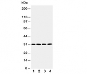 Western blot testing of SOD3 antibody and Lane 1:  human placenta;  2: A549;  3: MM231;  4: MCF-7 cell lysate.  Predicted molecular weight: 26~32 kDa.