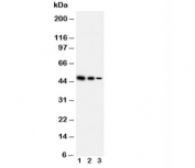 Western blot with TRIF antibody and recombinant human protein;  Lane 1: 5ng;  2: 2.5ng;  3: 1.25ng