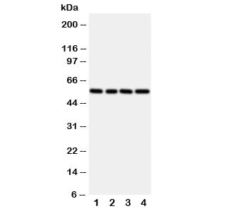 Western blot testing of TXNRD2 antibody and rat samples 1: kidney; 2: ovary; 3: liver; 4: human SMMC-7721 cell lysate~
