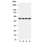 Western blot testing of TXNRD2 antibody and rat samples 1: kidney;  2: ovary;  3: liver;  4: human SMMC-7721 cell lysate