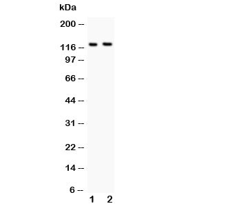 Western blot testing of BOC antibody and Lane 1: mouse brain; 2: NIH3T3 lysate. Predicted size ~121KD