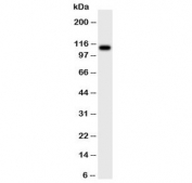 Western blot testing of CSF1R antibody and rat intestine tissue lysate.  Predicted molecular weight ~110 kDa.
