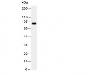 Western blot testing of CSF3R antibody and human placenta tissue lysate