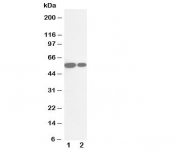 Western blot testing of Cytochrome P450 2E1 antibody and Lane 1:  rat liver;  2: mouse liver tissue lysate.  Predicted molecular weight ~56kDa.