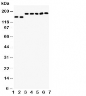 Western blot testing of DCC antibody and Lane 1:  rat brain;  2: mouse brain;  and human samples 3: U87;  4: SW620;  5: COLO320;  6: 293T;  7: HeLa cell lysate. Expected molecular weight: 155~190 kDa depending on glycosylation level.