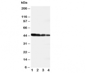 Western blot testing of DLL3 antibody and recombinant human protein;  Lane 1: 10ng;  2: 5ng;  3: 2.5ng;  4: 1.25ng