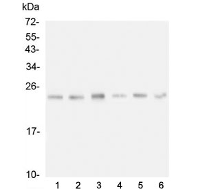 Western blot testing of 1) rat liver, 2) rat testis, 3) rat NRK cell, 4) mouse liver, 5) mouse testis and 6) mouse lung lysate with FSTL3 antibody. Predicted molecular weight ~22 kDa.~