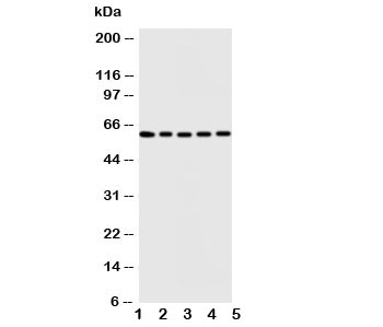 Western blot testing of Iduronate 2 sulfatase antibody and Lane 1: HeLa; 2: SMMC-7721; 3: A549; 4: MCF-7; 5: COLO cell lysate. Predicted size ~62KD~