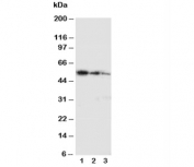 Western blot testing with Ki-67 antibody and partial human recombinant protein;  Lane 1: 10ng;  2: 5ng;  3: 2.5ng