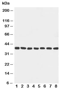 Western blot testing with Mek6 antibody and rat samples: 1. ovary; 2. spleen; 3. brain; 4. heart; 5. mouse NIH3T3; and human samples 6. HeLa; 7. Jurkat; 8. MCF-7 cell lysate. Expected size ~37KD