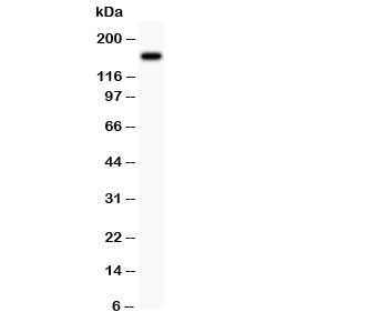 Western blot testing with MAP3K1 antibody and MCF-7 lysate. Predicted/observed size ~162KD~