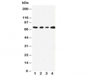Western blot testing with MEKK3 antibody;  Lane 1: HeLa;  2: A431;  3: MCF-7;  4: Jurkat cell lysate.  Expected size ~71KD