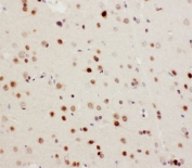 IHC-P: MEKK3 antibody testing of rat brain tissue