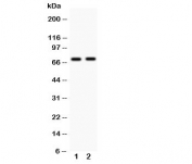 Western blot testing with MEKK3 antibody Lane 1: rat brain;  2: mouse brain.  Expected size ~71KD