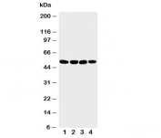 Western blot testing with Matrilin 3 antibody;  Lane 1: 293T;  2: COLO320;  3: HeLa;  4: A549 lysate