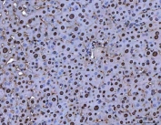 IHC staining of FFPE mouse liver tissue with MYBL2 antibody. HIER: boil tissue sections in pH8 EDTA for 20 min and allow to cool before testing.