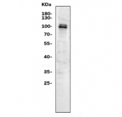 Western blot testing of human Raji cell lysate with MYBL2 antibody. Predicted molecular weight: ~79 kDa, may also be observed at 100~110 kDa.