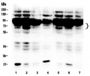 Western blot testing of NOX4 antibody human 1) HepG2, 2) SW620, 3) HK-2, 4) HL-60, 5) 293T, 6) SW579 and 6) SK-OV-3 cell lysate. Expected molecular weight: ~65 kDa, 75-80 kDa.