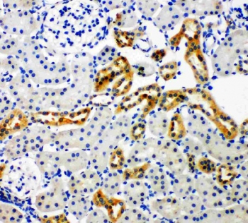 IHC-P: NOX4 antibody testing of rat kidney tissue
