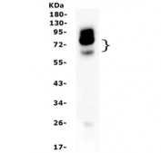 Western blot testing of NOX4 antibody and rat kidney lysate. Expected molecular weight: ~65 kDa, 75-80 kDa.